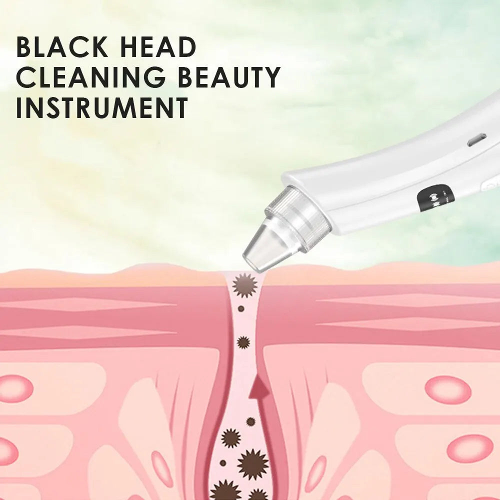 GlowPro 3-i-1 Ansiktsrenser – Blackhead & Dead Skin Remover med Vakuum og ION-teknologi