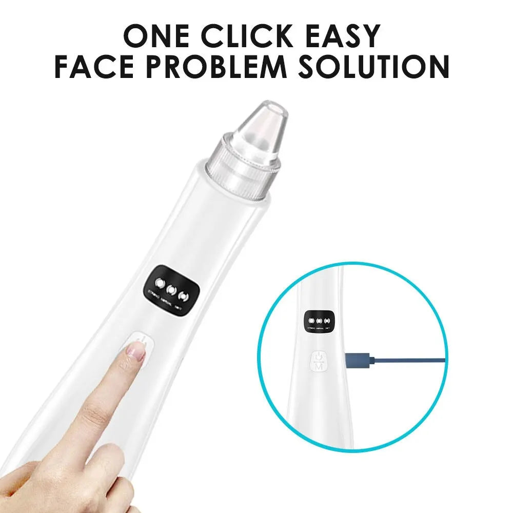 GlowPro 3-i-1 Ansiktsrenser – Blackhead & Dead Skin Remover med Vakuum og ION-teknologi
