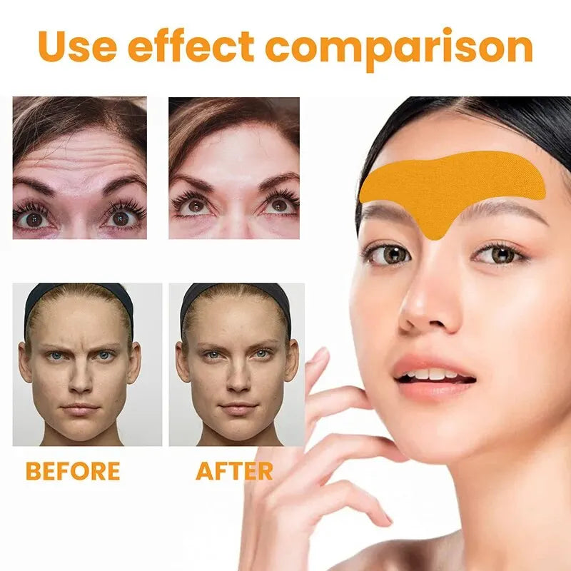 SmoothLift Forehead Wrinkle Patch – Stram Opp & Glatt Ut Rynker