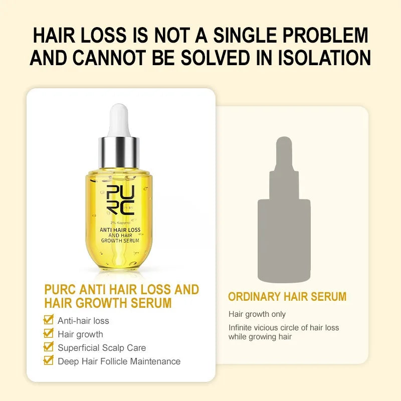 Anti Hair Loss Serum – Hair Growth & Scalp Repair (50 ml)