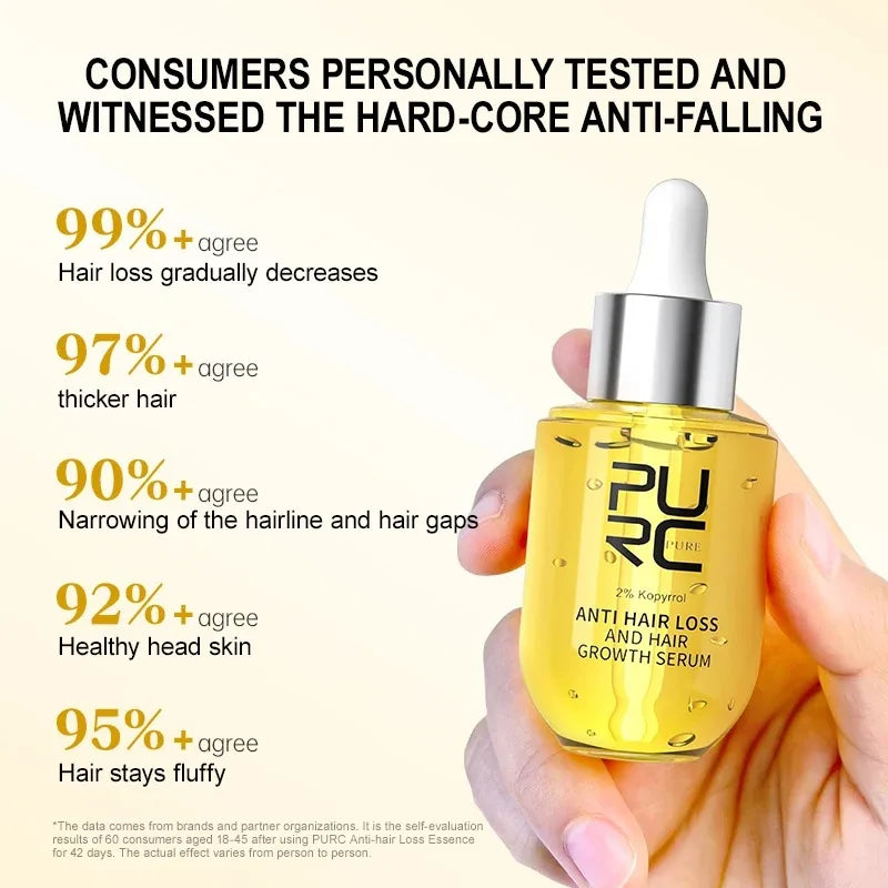 Anti Hair Loss Serum – Hair Growth & Scalp Repair (50 ml)