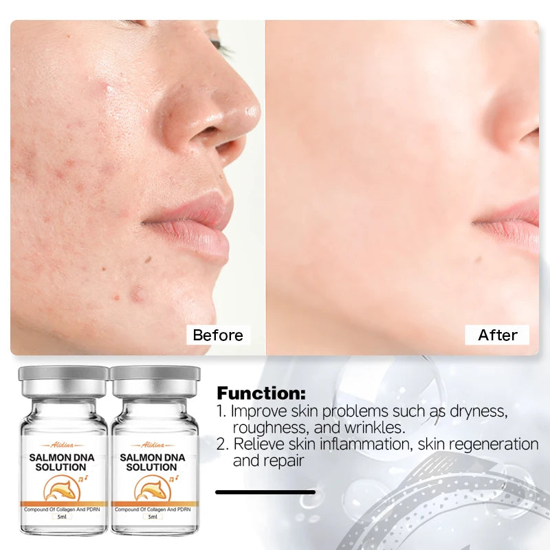 PDRN Salmon DNA - Anti aging booster serum