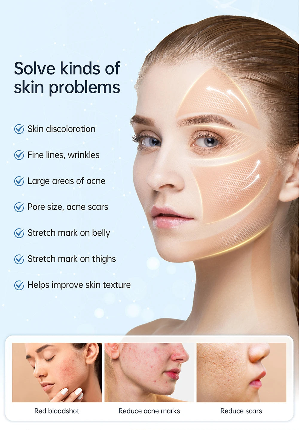 Hydra pen H5 – 2-i-1 EMS + Dermapen skin care kit for hjemmebruk